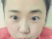 爆照有勛章？哪毛我沒有………